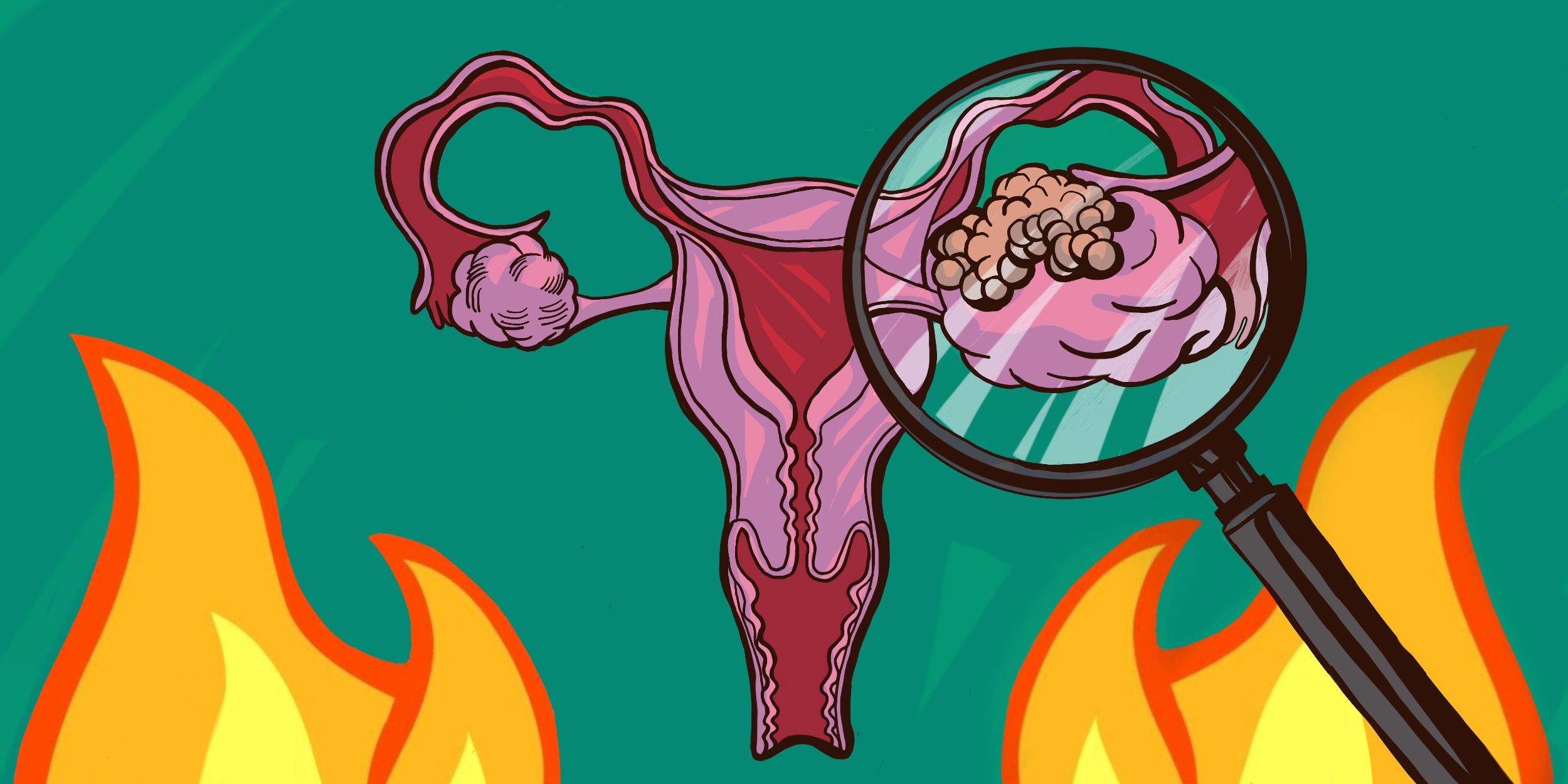 Воспаление яичников – что это такое