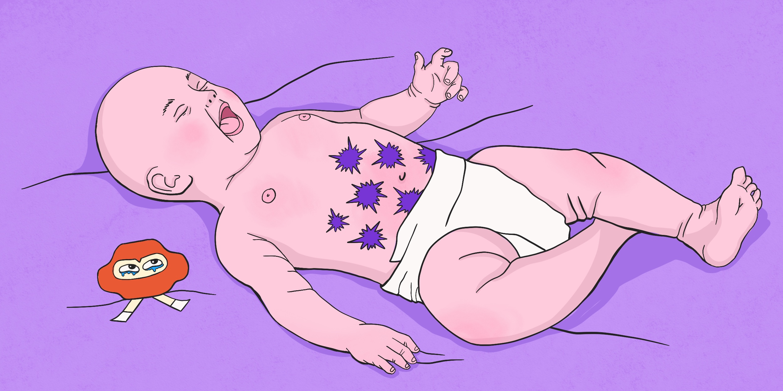 Симптомы колик у младенцев