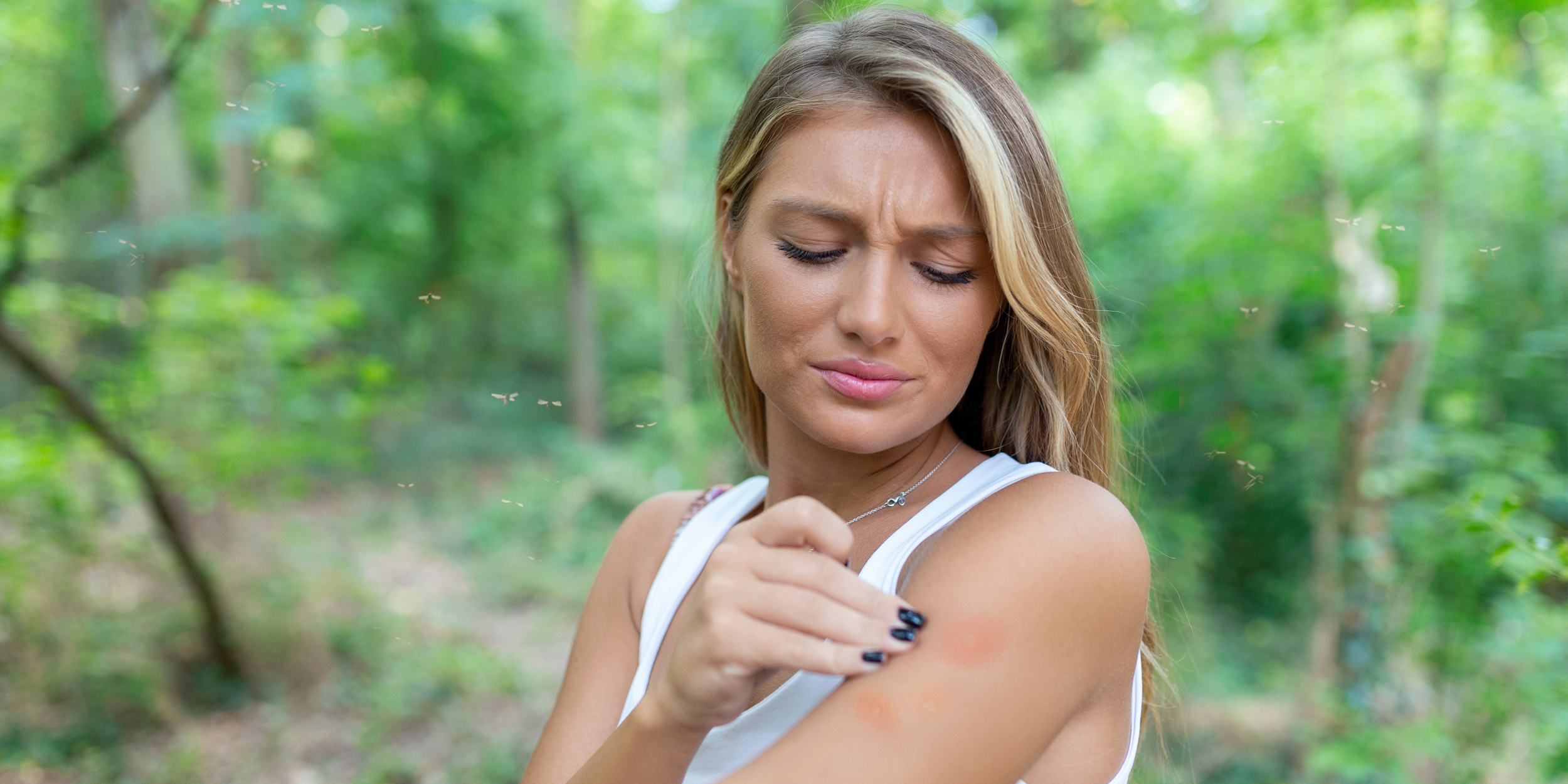 10 способов снять зуд от комариных укусов